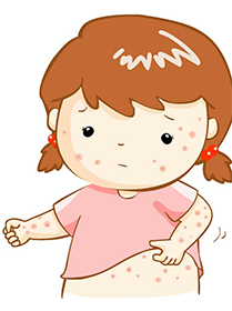 夏季孩子皮膚奇癢 是濕疹嗎？